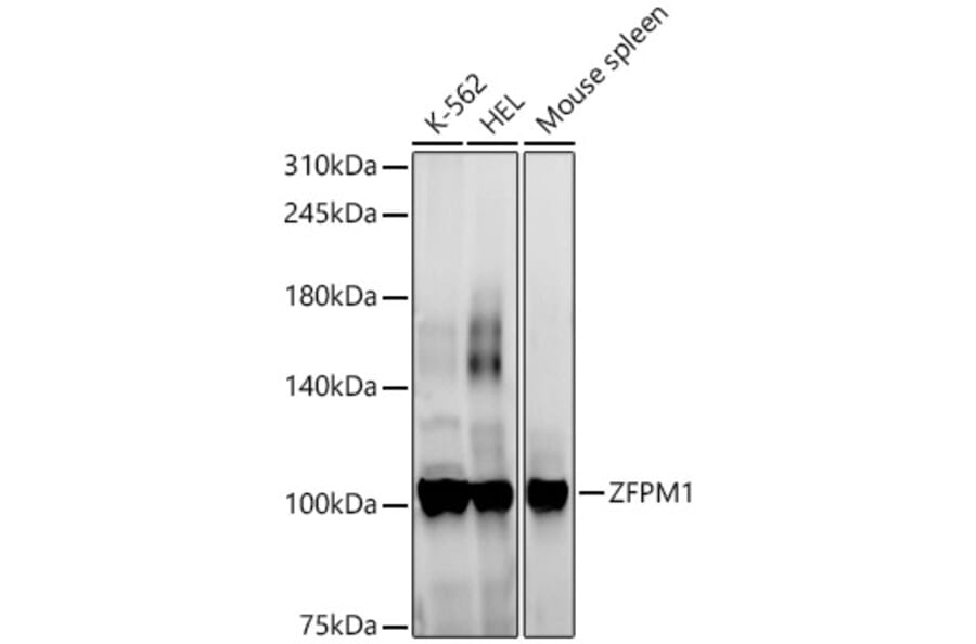 Western Blot - Anti-FOG1 Antibody (A307836) - Antibodies.com