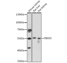 Western Blot - Anti-Emi1 Antibody (A307837) - Antibodies.com