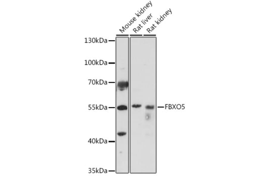Western Blot - Anti-Emi1 Antibody (A307837) - Antibodies.com