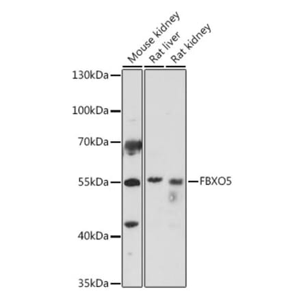 Western Blot - Anti-Emi1 Antibody (A307837) - Antibodies.com