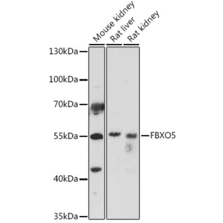 Western Blot - Anti-Emi1 Antibody (A307837) - Antibodies.com