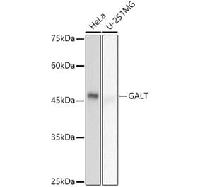 Western Blot - Anti-GALT Antibody [ARC2955] (A307838) - Antibodies.com