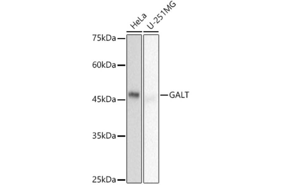 Western Blot - Anti-GALT Antibody [ARC2955] (A307838) - Antibodies.com