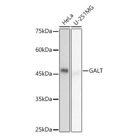 Western Blot - Anti-GALT Antibody [ARC2955] (A307838) - Antibodies.com