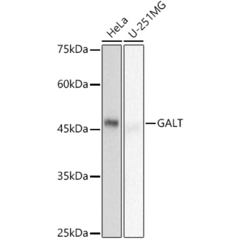 Western Blot - Anti-GALT Antibody [ARC2955] (A307838) - Antibodies.com