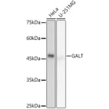 Western Blot - Anti-GALT Antibody [ARC2955] (A307838) - Antibodies.com