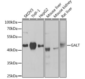 Western Blot - Anti-GALT Antibody (A307839) - Antibodies.com