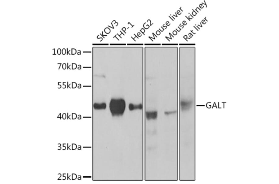 Western Blot - Anti-GALT Antibody (A307839) - Antibodies.com