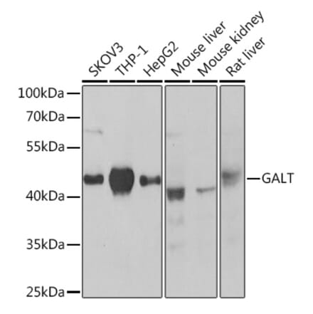 Western Blot - Anti-GALT Antibody (A307839) - Antibodies.com