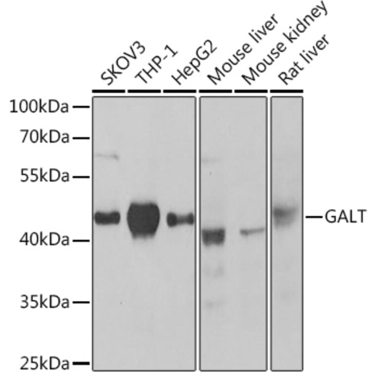 Western Blot - Anti-GALT Antibody (A307839) - Antibodies.com