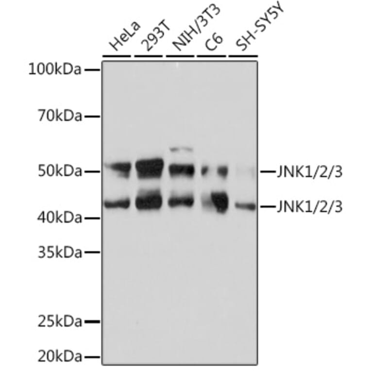 Western Blot - Anti-JNK1 + JNK2 + JNK3 Antibody [ARC0291] (A307841) - Antibodies.com