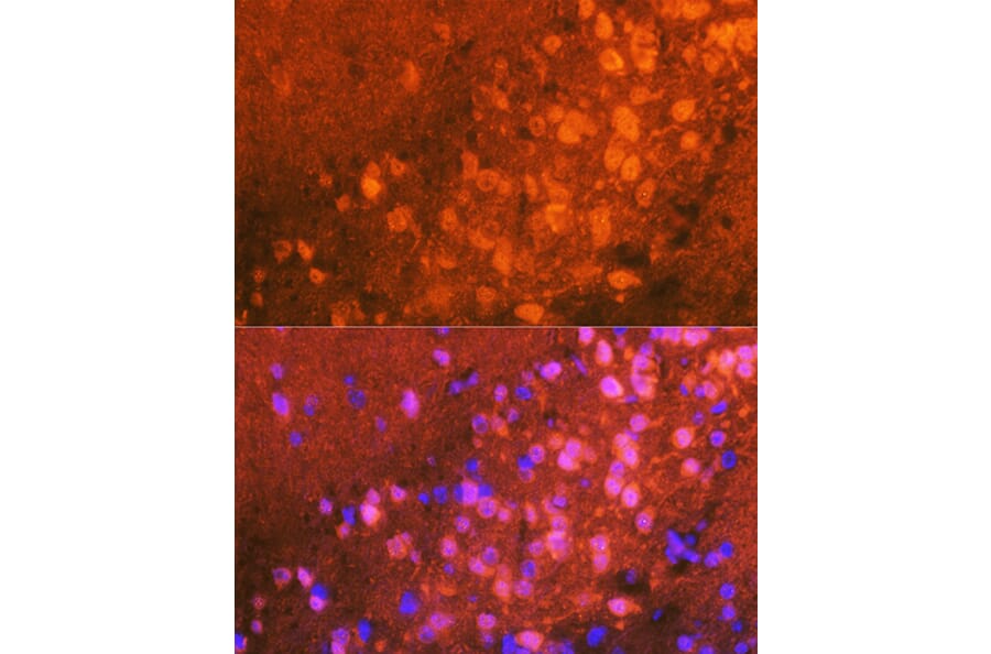 Immunofluorescence - Anti-JNK1 + JNK2 + JNK3 Antibody [ARC0291] (A307841) - Antibodies.com