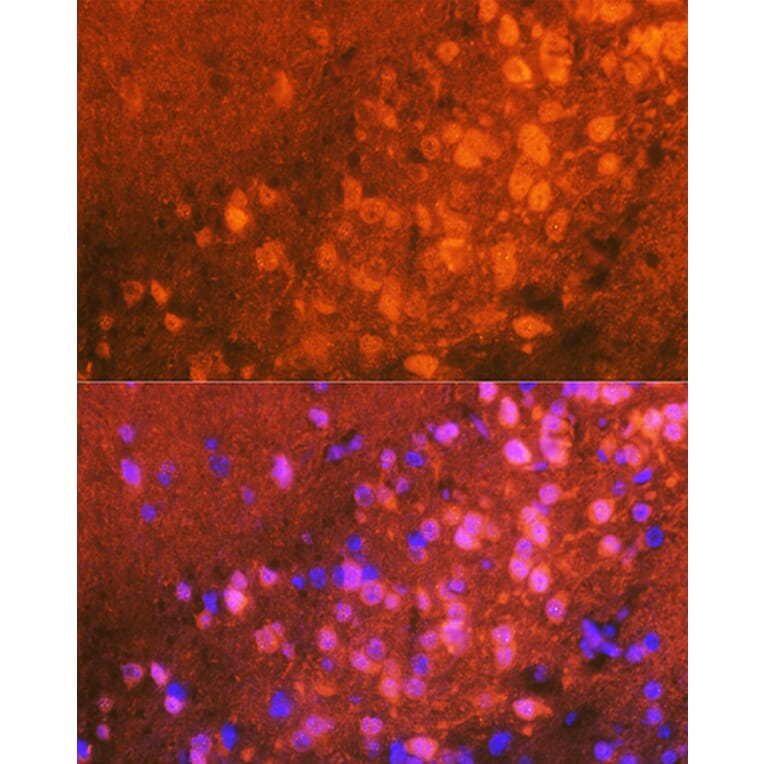 Immunofluorescence - Anti-JNK1 + JNK2 + JNK3 Antibody [ARC0291] (A307841) - Antibodies.com
