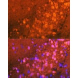 Immunofluorescence - Anti-JNK1 + JNK2 + JNK3 Antibody [ARC0291] (A307841) - Antibodies.com