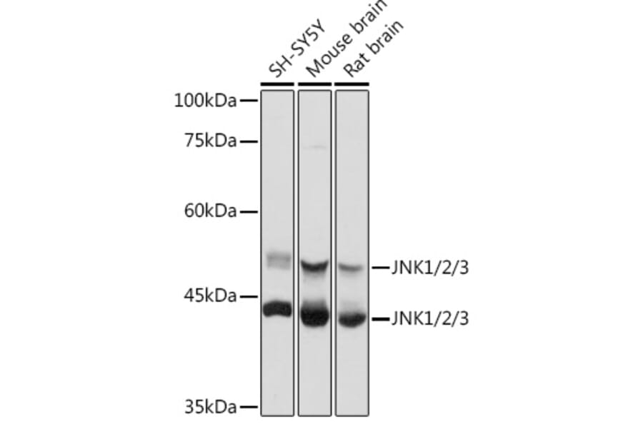 Western Blot - Anti-JNK1 + JNK2 + JNK3 Antibody (A307842) - Antibodies.com