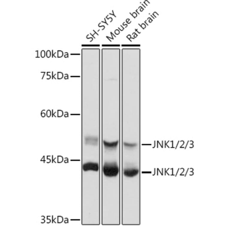 Western Blot - Anti-JNK1 + JNK2 + JNK3 Antibody (A307842) - Antibodies.com
