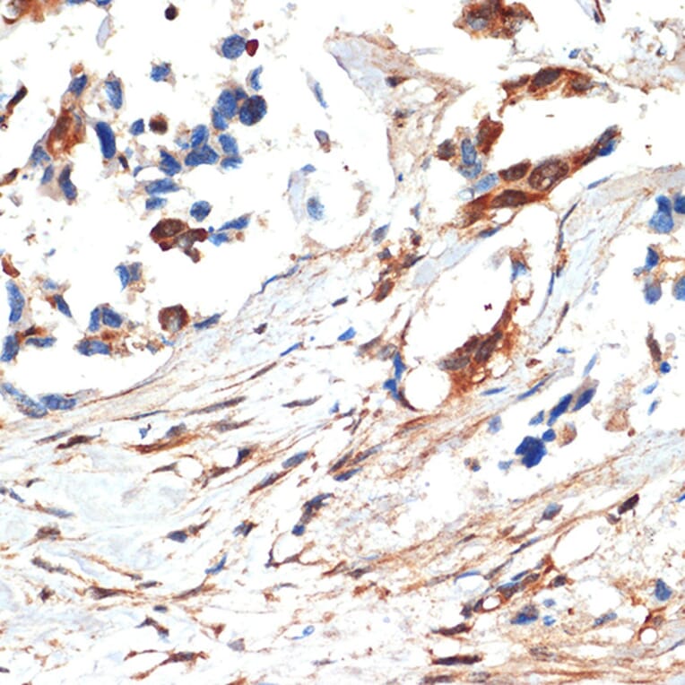 Immunohistochemistry - Anti-JNK1 + JNK2 + JNK3 Antibody (A307842) - Antibodies.com