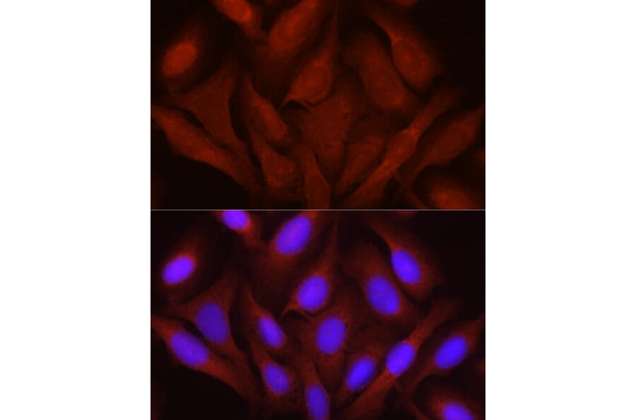 Immunofluorescence - Anti-JNK1 + JNK2 + JNK3 Antibody (A307842) - Antibodies.com