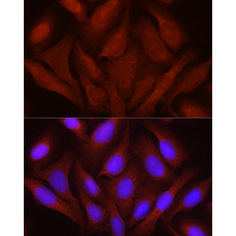 Immunofluorescence - Anti-JNK1 + JNK2 + JNK3 Antibody (A307842) - Antibodies.com