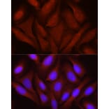 Immunofluorescence - Anti-JNK1 + JNK2 + JNK3 Antibody (A307842) - Antibodies.com