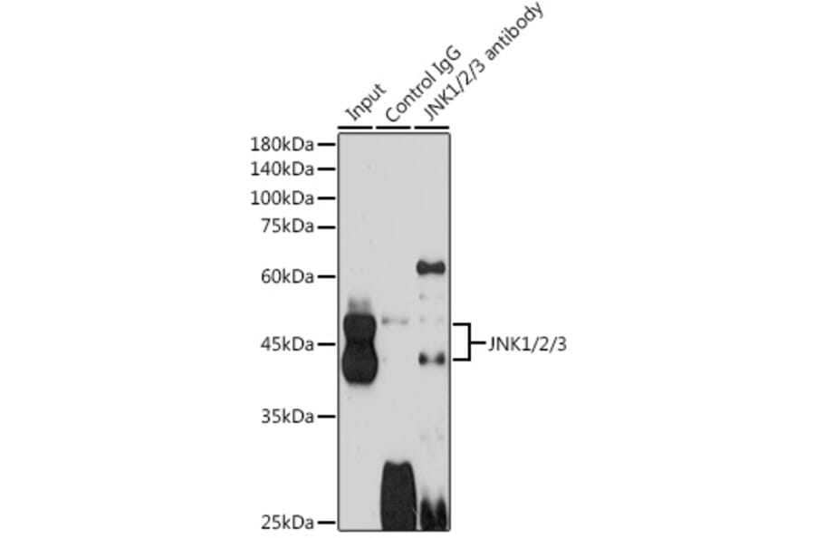 Western Blot - Anti-JNK1 + JNK2 + JNK3 Antibody (A307842) - Antibodies.com