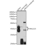 Western Blot - Anti-JNK1 + JNK2 + JNK3 Antibody (A307842) - Antibodies.com