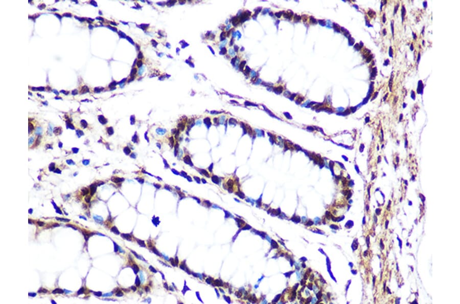 Immunohistochemistry - Anti-JNK1 + JNK2 + JNK3 Antibody [ARC1163] (A307843) - Antibodies.com
