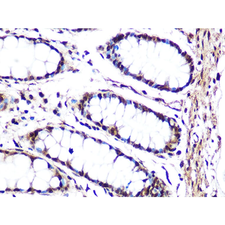 Immunohistochemistry - Anti-JNK1 + JNK2 + JNK3 Antibody [ARC1163] (A307843) - Antibodies.com