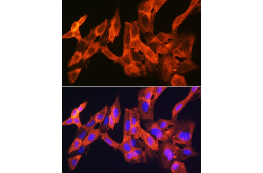 Immunofluorescence - Anti-JNK1 + JNK2 + JNK3 Antibody [ARC1163] (A307843) - Antibodies.com