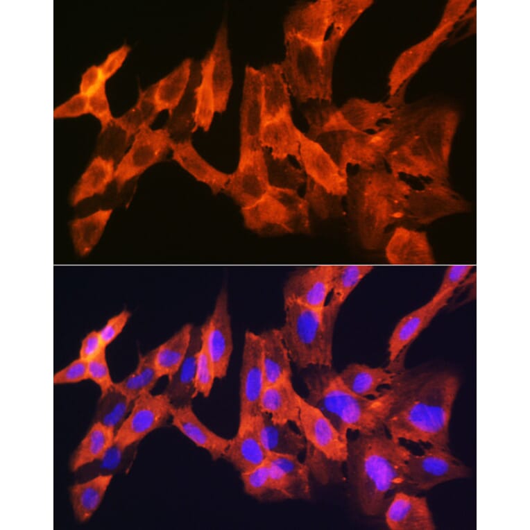 Immunofluorescence - Anti-JNK1 + JNK2 + JNK3 Antibody [ARC1163] (A307843) - Antibodies.com