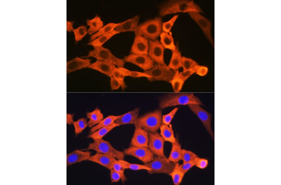 Immunofluorescence - Anti-JNK1 + JNK2 + JNK3 Antibody [ARC1163] (A307843) - Antibodies.com