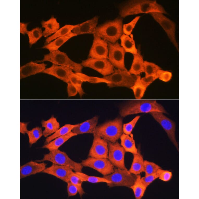 Immunofluorescence - Anti-JNK1 + JNK2 + JNK3 Antibody [ARC1163] (A307843) - Antibodies.com