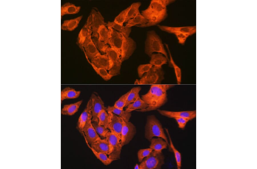Immunofluorescence - Anti-JNK1 + JNK2 + JNK3 Antibody [ARC1163] (A307843) - Antibodies.com