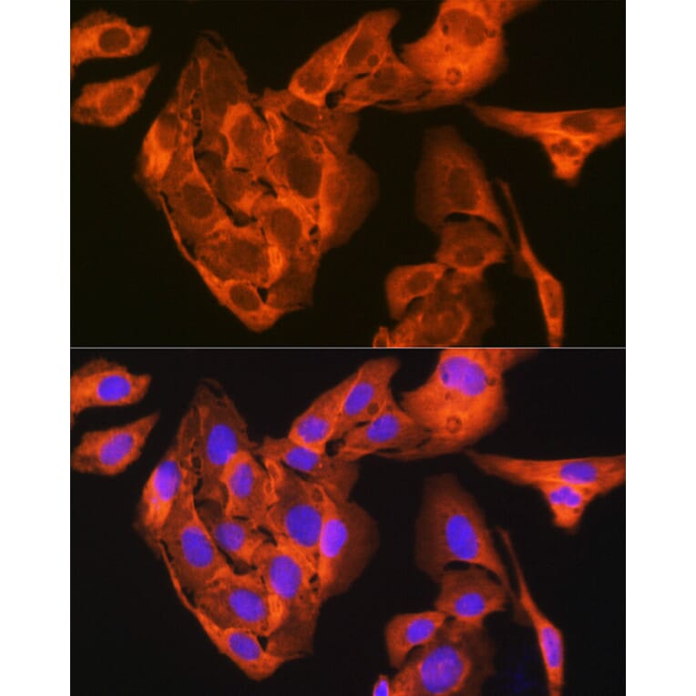 Immunofluorescence - Anti-JNK1 + JNK2 + JNK3 Antibody [ARC1163] (A307843) - Antibodies.com