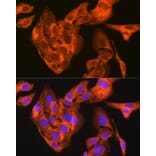 Immunofluorescence - Anti-JNK1 + JNK2 + JNK3 Antibody [ARC1163] (A307843) - Antibodies.com