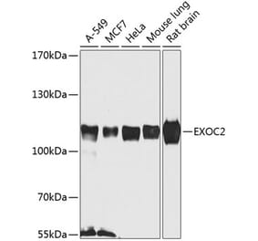 Western Blot - Anti-EXOC2 Antibody (A307844) - Antibodies.com