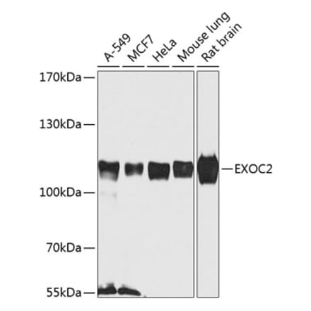 Western Blot - Anti-EXOC2 Antibody (A307844) - Antibodies.com