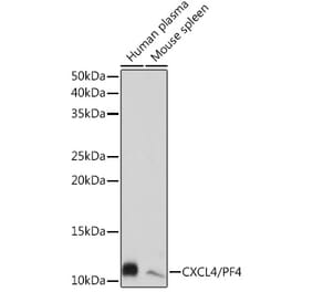 Western Blot - Anti-PF4 Antibody [ARC2076] (A307846) - Antibodies.com