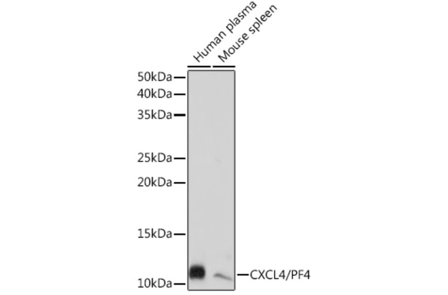 Western Blot - Anti-PF4 Antibody [ARC2076] (A307846) - Antibodies.com