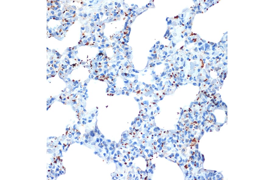 Immunohistochemistry - Anti-PF4 Antibody [ARC2076] (A307846) - Antibodies.com