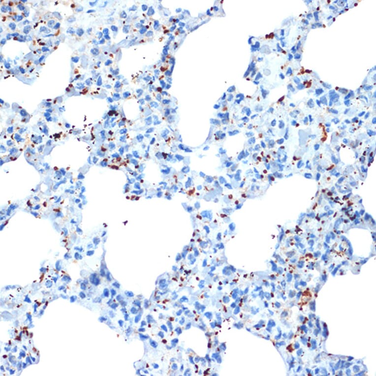 Immunohistochemistry - Anti-PF4 Antibody [ARC2076] (A307846) - Antibodies.com