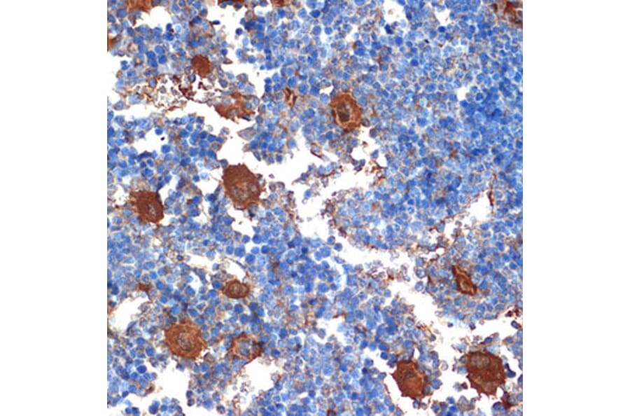 Immunohistochemistry - Anti-PF4 Antibody [ARC2076] (A307846) - Antibodies.com