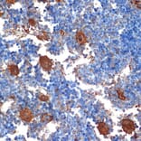 Immunohistochemistry - Anti-PF4 Antibody [ARC2076] (A307846) - Antibodies.com