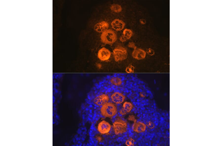 Immunofluorescence - Anti-PF4 Antibody [ARC2076] (A307846) - Antibodies.com