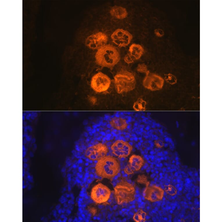 Immunofluorescence - Anti-PF4 Antibody [ARC2076] (A307846) - Antibodies.com