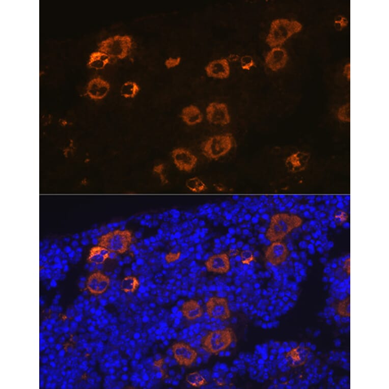 Immunofluorescence - Anti-PF4 Antibody [ARC2076] (A307846) - Antibodies.com