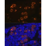 Immunofluorescence - Anti-PF4 Antibody [ARC2076] (A307846) - Antibodies.com