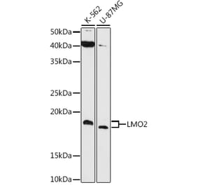 Western Blot - Anti-LMO2 Antibody [ARC1422] (A307847) - Antibodies.com