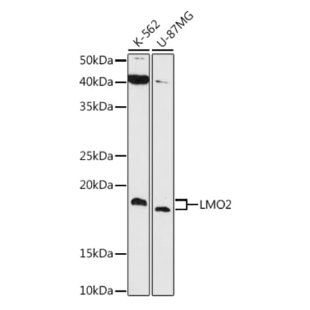 Western Blot - Anti-LMO2 Antibody [ARC1422] (A307847) - Antibodies.com