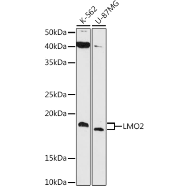 Western Blot - Anti-LMO2 Antibody [ARC1422] (A307847) - Antibodies.com